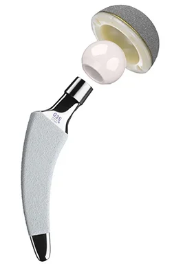 Schmerzen nach Gelenkersatzoperation